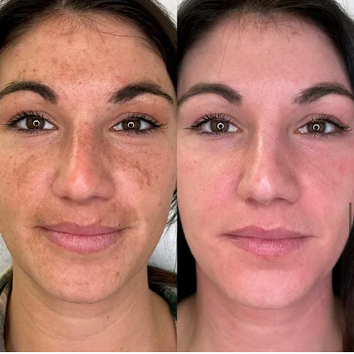 Gentle enough for my sensitive skin — and it actually works