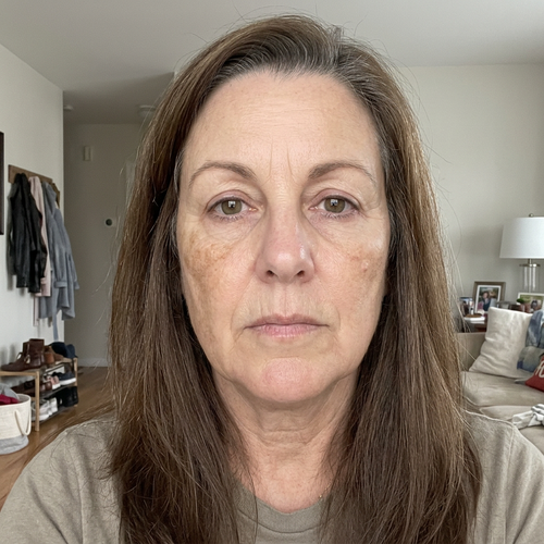 I finally see my dark spots fading