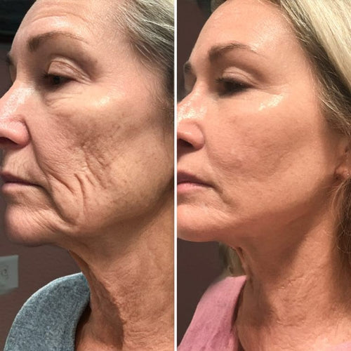 Gentle enough for my sensitive skin — and it actually works