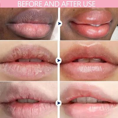 VELLARA - PDRN Renewing Lip Serum
