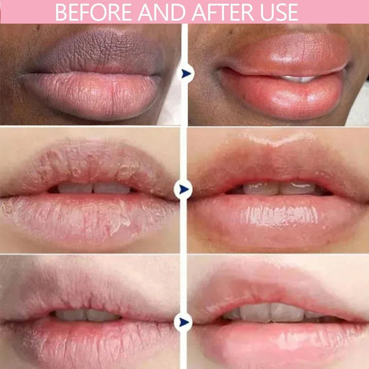 VELLARA - PDRN Renewing Lip Serum