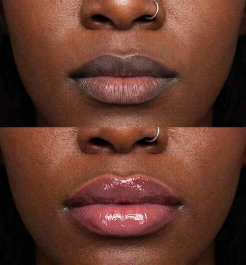 Bye-Bye Dry Texture