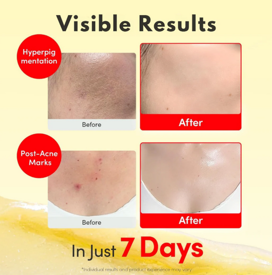 Vitamin Illuminating Serum & Cream Set