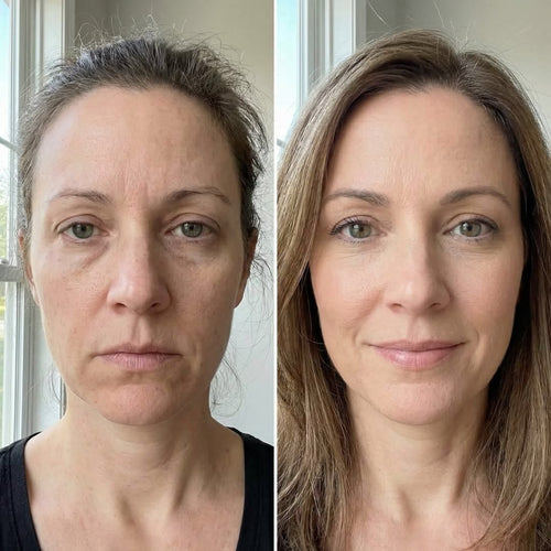 After 6 failed serums, this is the one