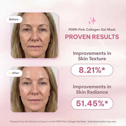 PDRN Salmon DNA & Collagen Jelly Masks (Set of 4)